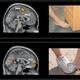 Image for article titled Brain Scans Reveal that Teen Bullies Get Pleasure from Your Pain
